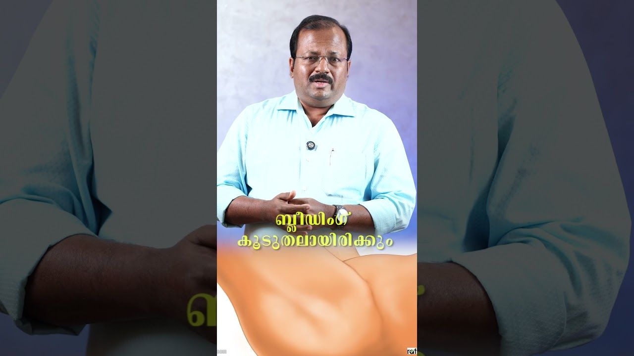  പ്രോസ്റ്റേറ്റ് വീക്കത്തിന് ഏറ്റവും ഫലപ്രദമായ ചികിത്സയാണ് ലേസർ. 