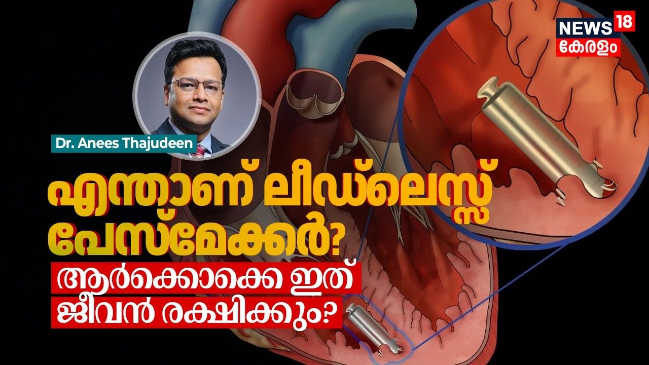 What is Leadless Pacemaker?