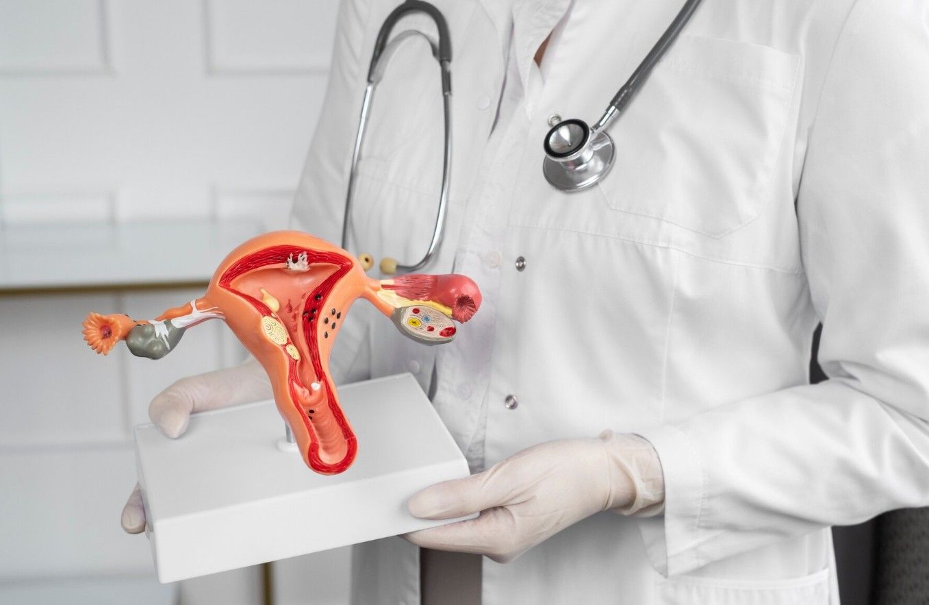 Polycystic Ovary Disease