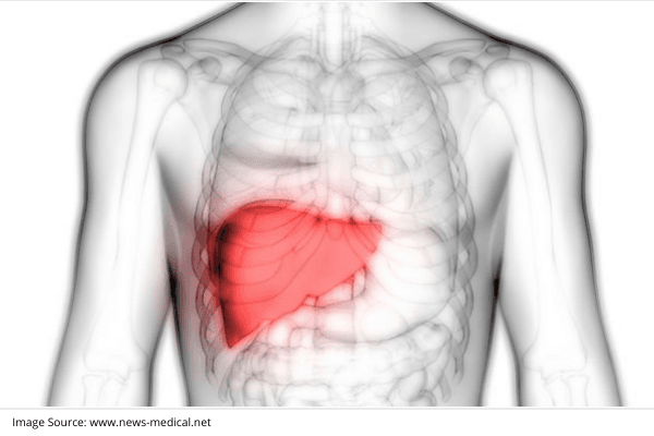 Treatment Options for Liver Cancers