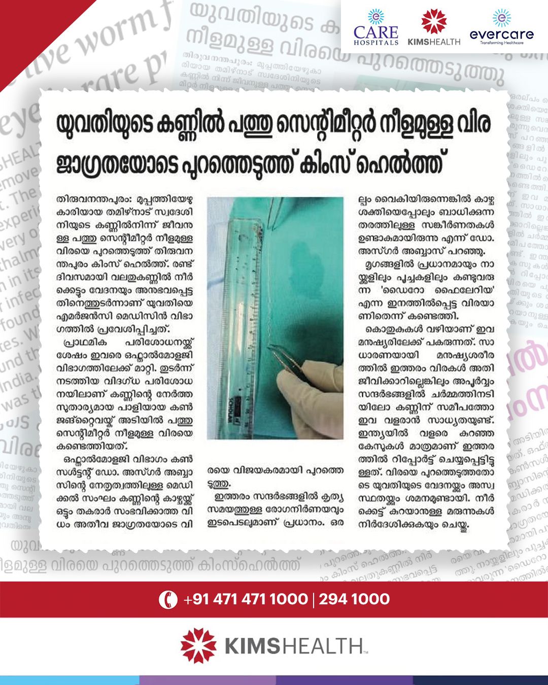 യുവതിയുടെ കണ്ണിൽ നിന്ന് 10 സെന്റീമീറ്റർ നീളമുള്ള ജീവനുള്ള വിരയെ പുറത്തെടുത്തു!