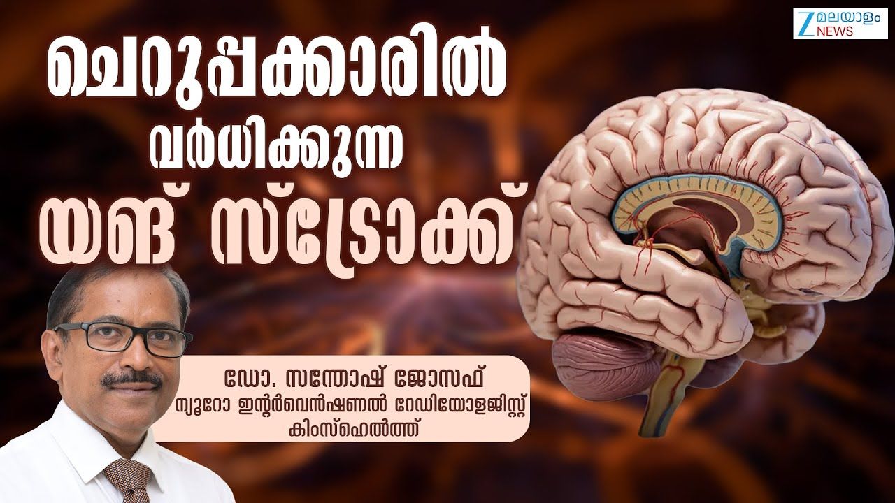 Young Stroke | കിംസ് ഹെൽത്ത് ന്യൂറോ ഇന്റർവെൻഷണൽ റേഡിയോളജി വിഭാഗം സീനിയർ കൺസൽട്ടന്റ് ആൻഡ് ക്ലിനിക്കൽ ലീഡ് ഡോ. സന്തോഷ് ജോസഫ് വിശദീകരിക്കുന്നു
